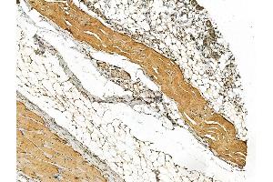 ABIN6262768 and ABIN6266577 at 1/100 staining Rat skin tissue by IHC-P. (Keratin 10 抗体  (Internal Region))