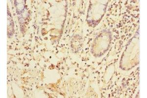 Immunohistochemistry of paraffin-embedded human small intestine tissue using ABIN7172318 at dilution of 1:100 (TRIAP1 抗体  (AA 1-76))