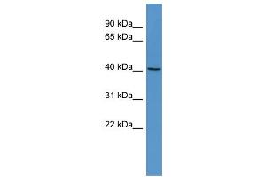 WB Suggested Anti-RASSF6 Antibody Titration: 0. (RASSF6 抗体  (Middle Region))