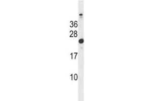 Western Blotting (WB) image for anti-HRas proto-oncogene, GTPase (HRAS) (AA 151-179) antibody (ABIN3028695)
