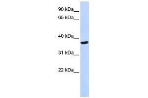 SPDYA antibody used at 1 ug/ml to detect target protein. (SPDYA 抗体)