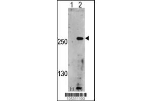 Western blot analysis of PIP5K3 using rabbit polyclonal PIP5K3 Antibody using 293 cell lysates (2 ug/lane) either nontransfected (Lane 1) or transiently transfected with the PIP5K3 gene (Lane 2). (PIKFYVE 抗体  (AA 1531-1561))