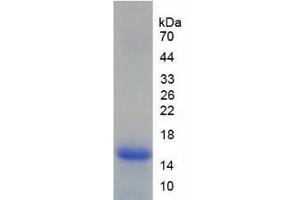 SDS-PAGE analysis of Human Lymphocyte Antigen 96 Protein. (LY96 蛋白)