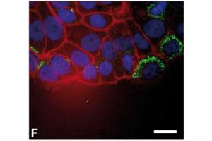 Immunofluorescence image of Thymosin beta10 staining of MCF7 cells in a wound/scratch assay. (Thymosin beta 10 抗体  (AA 1-14))