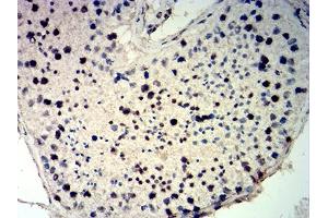 Immunohistochemical analysis of paraffin-embedded testis tissues using CDKN1C mouse mAb with DAB staining. (CDKN1C 抗体)