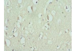 Immunohistochemistry of paraffin-embedded human brain tissue using ABIN7151371 at dilution of 1:100 (ENTPD2 抗体  (AA 28-268))