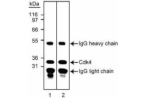 Immunoprecipitiation/western blot analysis of Cdk4. (CDK4 抗体)