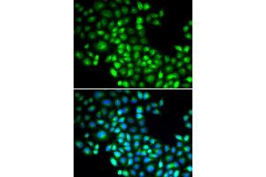Immunofluorescence analysis of U20S cell using FOXP1 antibody. (FOXP1 抗体)