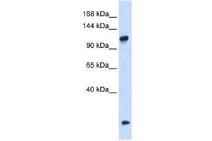 HEATR4 antibody used at 1 ug/ml to detect target protein. (HEATR4 抗体  (N-Term))