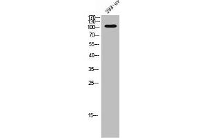 Western Blot analysis of 293T-UV cells using EphA3 Polyclonal Antibody (EPH Receptor A3 抗体  (C-Term))