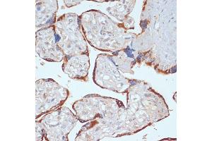 Immunohistochemistry of paraffin-embedded human placenta using PDGFRB antibody (ABIN3023138, ABIN3023139, ABIN3023140 and ABIN6219408) at dilution of 1:100 (40x lens). (PDGFRB 抗体  (AA 887-1106))