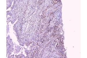 IHC analysis of PBP using anti-PBP antibody (ABIN5693043). (PEBP1 抗体)