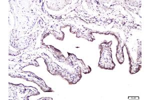 Paraformaldehyde-fixed, paraffin embedded rat bladder, Antigen retrieval by boiling in sodium citrate buffer (pH6) for 15min, Block endogenous peroxidase by 3% hydrogen peroxide for 30 minutes, Blocking buffer (normal goat serum) at 37°C for 20min, Antibody incubation with Syndecan 1 Polyclonal Antibody, Unconjugated  at 1:400 overnight at 4°C, followed by a conjugated secondary and for 20 minutes and DAB staining. (Syndecan 1 抗体  (AA 201-310))