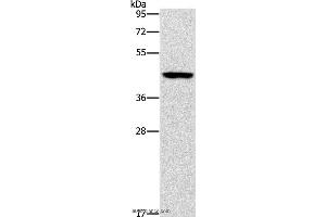 Western blot analysis of Mouse brain tissue, using B3GAT1 Polyclonal Antibody at dilution of 1:400 (CD57 抗体)