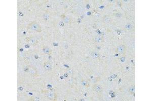 Immunohistochemistry of paraffin-embedded Mouse brain using SLC22A5 Polyclonal Antibody at dilution of 1:100 (40x lens). (SLC22A5 抗体)