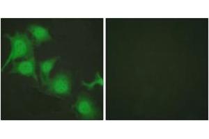 Immunofluorescence analysis of HuvEc cells, using Nrf2 Antibody. (NRF2 抗体  (AA 556-605))