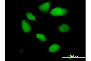 Immunofluorescence of purified MaxPab antibody to UNG on HeLa cell. (UNG 抗体  (AA 1-304))