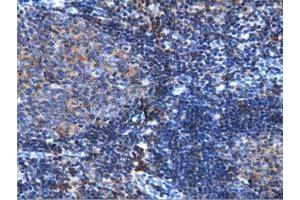 Immunohistochemistry (IHC) image for anti-rho GTPase Activating Protein 25 (ARHGAP25) antibody (ABIN1496706) (ARHGAP25 抗体)