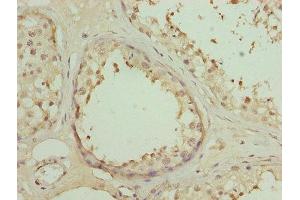 Immunohistochemistry of paraffin-embedded human testis tissue using ABIN7150657 at dilution of 1:100 (DSCR9 抗体  (AA 1-149))