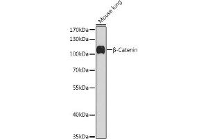 Western blot analysis of extracts of Mouse lung, using β-Catenin antibody (ABIN1684202, ABIN1512789, ABIN3020926 and ABIN3020928) at 1:1000 dilution. (CTNNB1 抗体)