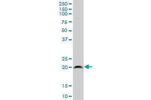RPL21 polyclonal antibody (A01), Lot # 051220JC01 Western Blot analysis of RPL21 expression in HepG2 . (RPL21 抗体  (AA 2-85))
