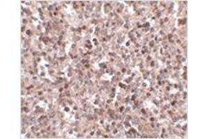 Immunohistochemistry (Paraffin-embedded Sections) (IHC (p)) image for anti-Killer Cell Lectin-Like Receptor, Subfamily A, Member 1 (KLRA1) (C-Term) antibody (ABIN783823)