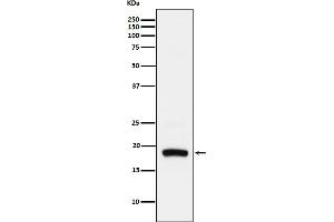 Western Blotting (WB) image for anti-ADP-Ribosylation Factor 5 (ARF5) antibody (ABIN7606808)