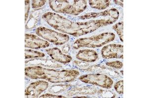 Immunohistochemistry (IHC) image for anti-AlkB, Alkylation Repair Homolog 1 (ALKBH1) antibody (ABIN7265552)