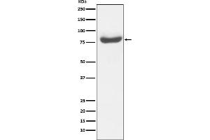 Western blot analysis of RAP80 expression in 293T cell lysate.