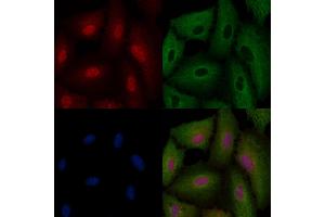 ABIN6264433 and ABIN6276469 staining  cells by IF/ICC. (PRMT1 抗体  (C-Term))
