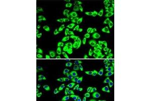 Immunofluorescence analysis of MCF7 cells using RPL14 Polyclonal Antibody (RPL14 抗体)