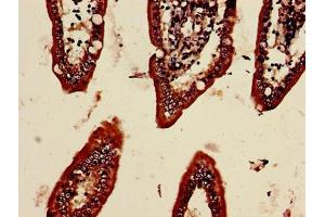 Immunohistochemistry of paraffin-embedded human small intestine tissue using ABIN7159804 at dilution of 1:100 (Midkine 抗体  (AA 21-143))