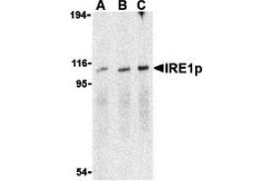 Western Blotting (WB) image for anti-Endoplasmic Reticulum To Nucleus Signaling 1 (ERN1) (C-Term) antibody (ABIN1030448) (ERN1 抗体  (C-Term))