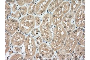 Immunohistochemical staining of paraffin-embedded pancreas tissue using anti-TYRO3mouse monoclonal antibody. (TYRO3 抗体)