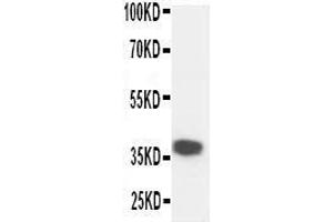 Anti-Kallikrein 5 antibody, Western blotting WB: Mouse Liver Tissue Lysate (Kallikrein 5 抗体  (C-Term))