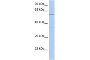 Image no. 1 for anti-Tyrosine Hydroxylase (TH) (AA 35-84) antibody (ABIN6742196) (Tyrosine Hydroxylase 抗体  (AA 35-84))