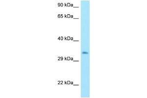 WB Suggested Anti-MTX3 Antibody Titration: 1. (MTX3 抗体  (C-Term))