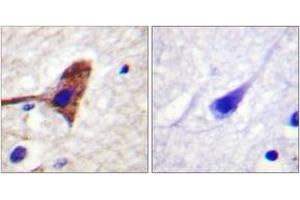 Immunohistochemistry analysis of paraffin-embedded human brain tissue, using mTOR (Ab-2481) Antibody. (MTOR 抗体  (AA 2447-2496))