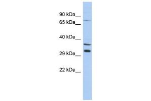 TSGA13 antibody used at 1 ug/ml to detect target protein. (TSGA13 抗体  (Middle Region))