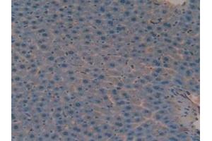 Immunohistochemistry (IHC) image for anti-Versican (Vcan) (AA 3058-3299) antibody (ABIN7434116)