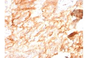 Formalin-fixed, paraffin-embedded human Kidney stained with CD10 Mouse Monoclonal Antibody (MME/2590). (MME 抗体  (AA 297-483))