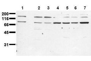 Western Blotting (WB) image for anti-Insulin Receptor (INSR) (Beta Chain) antibody (ABIN126820) (Insulin Receptor 抗体  (Beta Chain))
