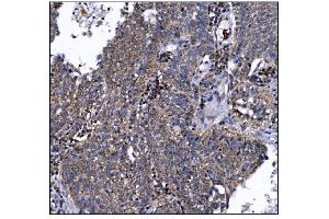IHC analysis of DLGAP1 using anti-DLGAP1 antibody (ABIN7600257). (DLGAP1 抗体  (AA 17-319))