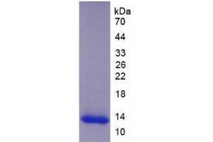 SDS-PAGE analysis of Human ADAMTS8 Protein. (ADAMTS8 蛋白)