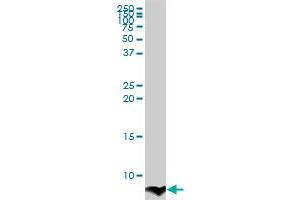 ATOX1 monoclonal antibody (M02), clone 3A2. (ATOX1 抗体  (AA 1-68))