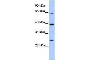 WB Suggested Anti-CIAO1 Antibody Titration:  0. (CIAO1 抗体  (Middle Region))