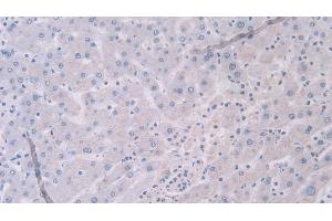 Immunohistochemistry (IHC) image for anti-Tenascin XB (TNXB) (AA 3835-4088) antibody (ABIN7434377)