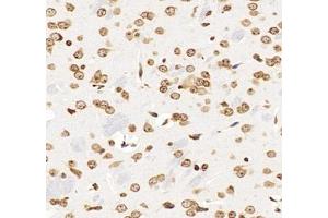 Immunohistochemistry analysis of paraffin-embedded mouse brain using,GSTT1 (ABIN7074091) at dilution of 1: 2000 (GSTT1 抗体)