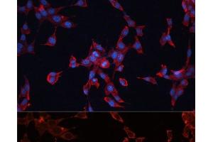 Immunofluorescence analysis of NIH-3T3 cells using GPC3 Polyclonal Antibody at dilution of 1:100 (40x lens). (Glypican 3 抗体)