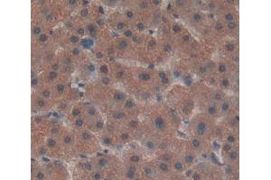 Used in DAB staining on fromalin fixed paraffin- embedded liver tissue (ADAMTS13 抗体  (AA 896-1131))